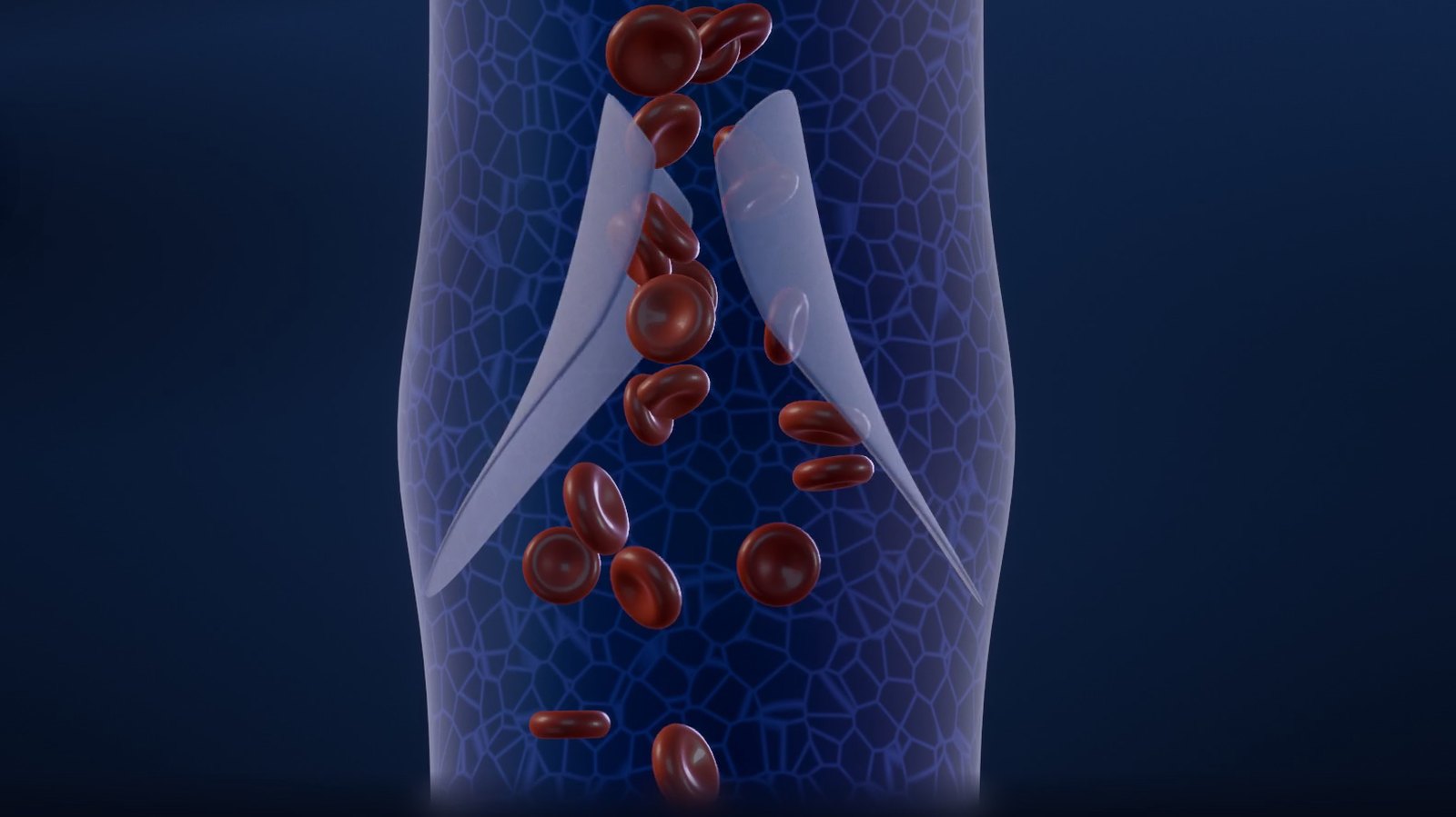 3D image from our video on varicocele: inside a vein, a valve closes among red blood cells
